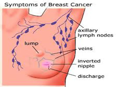 breast14.jpg
