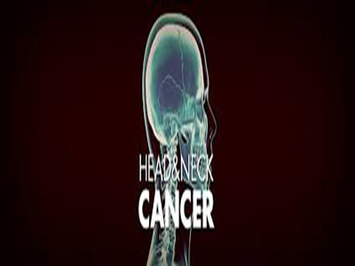 headneck13.jpg