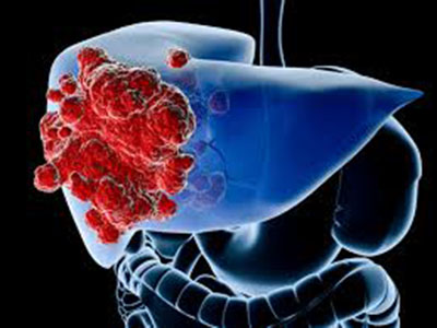 liver11.jpg