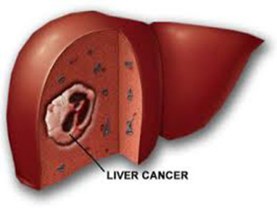 liver12.jpg