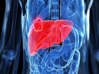 liver13.jpg
